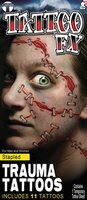 FX trauma tattoo stapled